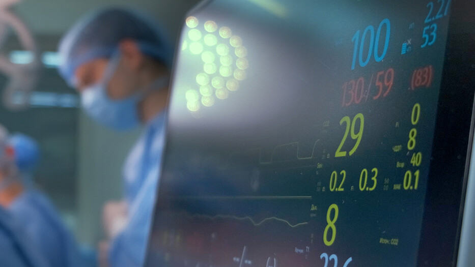 Hemodynamic monitoring Hemodynamic monitoring