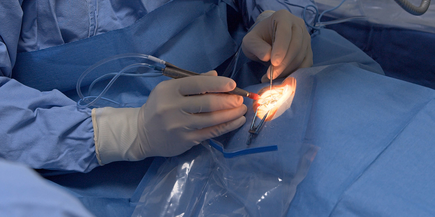 Eye surgery Eye surgery