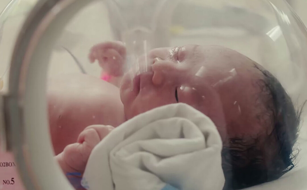Neonatal ventilators Neonatal ventilators